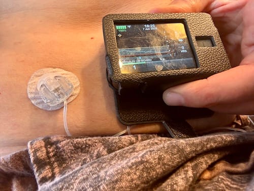 Human-technology relations: the contractual case of the ‘closed loop’ insulin pump